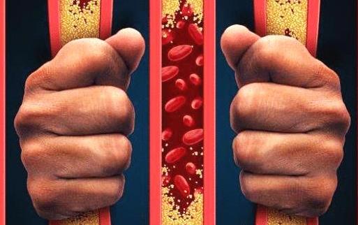 白领腰肌劳损的症状 能赶走腰肌劳损的运动方法