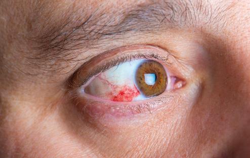 熬夜后如何调理身体呢