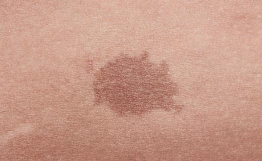 输液速度能不能自己调